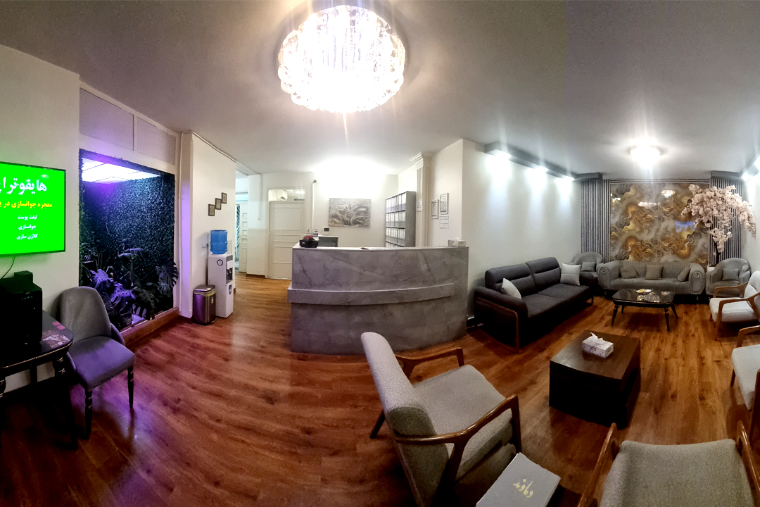 لیزر موهای زائد