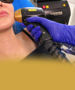 لیزر موهای زائد